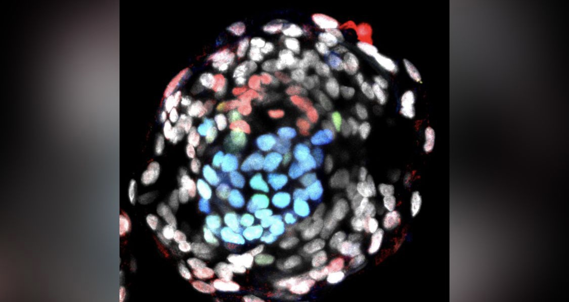 首个干细胞合成人类胚胎样结构诞生 有望打开早期胚胎发育的“黑匣子”